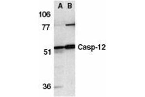 Western blot analysis of caspase-12 in human (A) and mouse (B) spleen tissue lysates with AP30190PU-N caspase-12 antibody at 1 μg/ml. (Caspase 12 抗体  (N-Term))