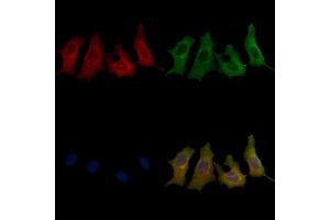 ABIN6258284 and ABIN6273886 staining HepG2 cells by IF/ICC. (GPR62 抗体  (C-Term))
