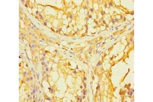 Immunohistochemistry of paraffin-embedded human testis tissue using ABIN7166699 at dilution of 1:100 (PAGE2B 抗体  (AA 1-111))