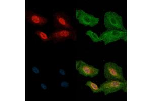 ABIN6263105 and ABIN6272810 staining  cells(H2O2 treatment) by IF/ICC. (MAP3K2 抗体  (C-Term))