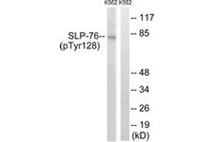 Western blot analysis of extracts from K562 cells treated with Na3VO4 0. (LCP2 抗体  (pTyr128))