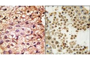 Image no. 2 for anti-Angiotensin I Converting Enzyme 2 (ACE2) (N-Term) antibody (ABIN358574) (ACE2 抗体  (N-Term))