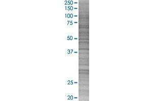 NME1 transfected lysate. (NME1 293T Cell Transient Overexpression Lysate(Denatured))