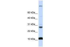 WB Suggested Anti-C19orf56 Antibody Titration:  0. (C19orf56 抗体  (N-Term))