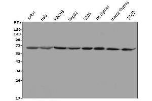 Western blot analysis of MBD1 using anti-MBD1 antibody (ABIN7603182).