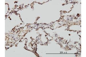 Immunoperoxidase of monoclonal antibody to EML2 on formalin-fixed paraffin-embedded human lung. (EML2 抗体  (AA 1-427))