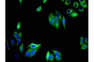 Immunofluorescent analysis of HepG2 cells using ABIN7173245 at dilution of 1:100 and Alexa Fluor 488-congugated AffiniPure Goat Anti-Rabbit IgG(H+L) (TMEM59 抗体  (AA 59-201))