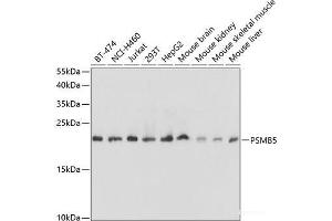 Western blot analysis of extracts of various cell lines using PSMB5 Polyclonal Antibody at dilution of 1:1000. (PSMB5 抗体)