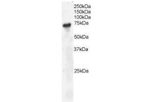 Image no. 2 for anti-B-Cell Linker (BLNK) (C-Term) antibody (ABIN374092) (B-Cell Linker 抗体  (C-Term))