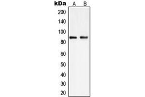 Western blot analysis of PIP5K1C expression in HEK293 (A), K562 (B) whole cell lysates. (PIP5K1C 抗体  (Center))