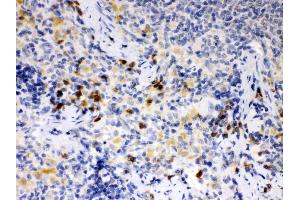 Anti- ATG14L Picoband antibody, IHC(P) IHC(P): Rat Spleen Tissue (ATG14 抗体  (N-Term))