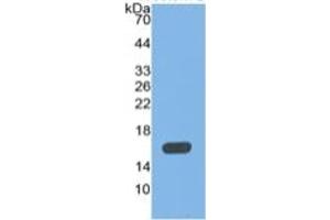 WB of Protein Standard: different control antibodies  against Highly purified E. (MBL2 ELISA 试剂盒)