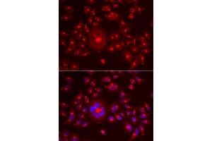 Immunofluorescence analysis of A549 cell using GORASP1 antibody. (GORASP1 抗体)