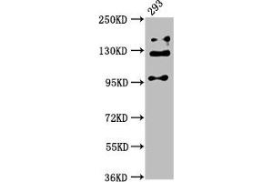 Western Blot Positive WB detected in: 293 whole cell lysate All lanes: RAB3GAP2 antibody at 5 μg/mL Secondary Goat polyclonal to rabbit IgG at 1/50000 dilution Predicted band size: 156, 24 kDa Observed band size: 110, 130, 150 kDa (RAB3GAP2 抗体  (Catalytic Subunit))
