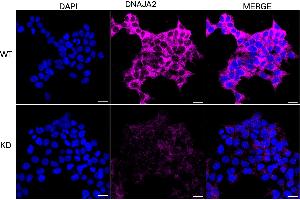 anti-DnaJ (Hsp40) Homolog, Subfamily A, Member 2 (DNAJA2) antibody
