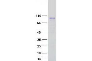 Western Blotting (WB) image for Fibronectin Leucine Rich Transmembrane Protein 2 (FLRT2) protein (Myc-DYKDDDDK Tag) (ABIN2721176)