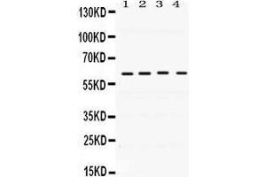 Western Blotting (WB) image for anti-BCL2-Associated Athanogene 3 (BAG3) (AA 100-561) antibody (ABIN3042341) (BAG3 抗体  (AA 100-561))