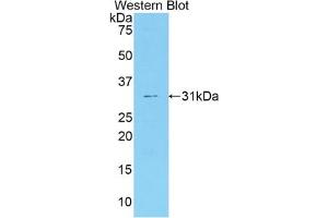 Detection of Recombinant F5, Mouse using Polyclonal Antibody to Coagulation Factor V (F5) (Coagulation Factor V 抗体  (AA 364-611))
