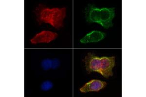 ABIN6264652 and ABIN6266628 staining HepG2 by IF/ICC. (RASH/RASK/RASN (N-Term) 抗体)