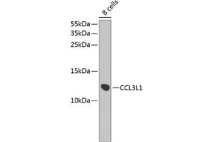 Western blot analysis of extracts of B-cell cells, using CCL3L1 antibody (ABIN3016836, ABIN3016837, ABIN3016838 and ABIN6219853) at 1:1000 dilution.