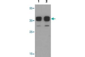 Western blot analysis of TSPY1 in A-20 cell lysate with TSPY1 polyclonal antibody  at (1) 0. (TSPY1 抗体  (C-Term))