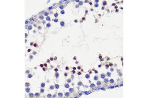 Immunohistochemistry of paraffin-embedded mouse testis using HFM1 antibody (ABIN6133318, ABIN6141741, ABIN6141743 and ABIN6224711) at dilution of 1:100 (40x lens). (HFM1 抗体  (AA 1-240))
