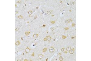 Immunohistochemistry of paraffin-embedded rat brain using CHRNA7 antibody. (CHRNA7 抗体)