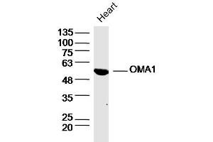 Rat heart lysates probed with OMA1 Polyclonal Antibody, Unconjugated  at 1:300 dilution and 4˚C overnight incubation. (OMA1 抗体  (AA 401-500))