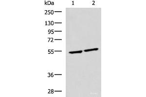 Western blot analysis of Raji and Jurkat cell lysates using IRF2 Polyclonal Antibody at dilution of 1:1350 (IRF2 抗体)