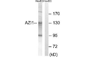 Immunohistochemistry analysis of paraffin-embedded human breast carcinoma tissue using AZI1 antibody. (AZI1 抗体)