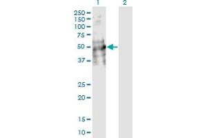 Western Blot analysis of DDC expression in transfected 293T cell line by DDC monoclonal antibody (M18), clone 8E8. (DDC 抗体  (AA 1-480))