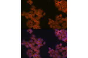Immunofluorescence analysis of HeLa cells using CDC23 Rabbit mAb (ABIN7266247) at dilution of 1:100 (40x lens). (CDC23 抗体)