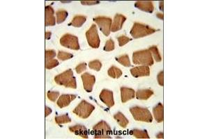 Formalin-fixed and paraffin-embedded human skeletal muscle reacted with TBC1D4 Antibody (N-term), which was peroxidase-conjugated to the secondary antibody, followed by DAB staining. (TBC1D4 抗体  (N-Term))