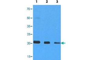 Western blot analysis of 293T cell extracts (35 ug) with NRAS monoclonal antibody, clone AT2G9  at 1:500 (Lane 1), 1:1000 (Lane 2) and 1:5000 (Lane 3) dilution. (GTPase NRas 抗体)