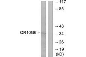 Western blot analysis of extracts from COLO cells, using OR10G6 Antibody. (OR10G6 抗体  (AA 261-310))