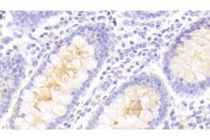 Detection of PLIN4 in Human Colon Tissue using Polyclonal Antibody to Perilipin 4 (PLIN4) (PLIN4 抗体  (AA 349-656))