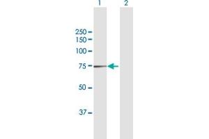 Western Blotting (WB) image for anti-NADH Dehydrogenase (Ubiquinone) Fe-S Protein 1, 75kDa (NADH-Coenzyme Q Reductase) (NDUFS1) (AA 1-727) antibody (ABIN948175)