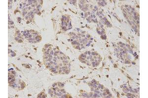 Immunohistochemistry (IHC) image for anti-Proteasome (Prosome, Macropain) 26S Subunit, Non-ATPase, 2 (PSMD2) antibody (ABIN1874389) (PSMD2 抗体)