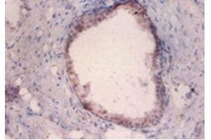 Immunohistochemistry of paraffin-embedded human prostate tissue using ABIN7159368 at dilution of 1:100 (PKMYT1 抗体  (AA 900-1101))
