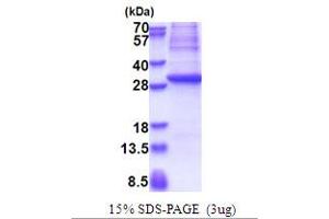GAD Protein (AA 1-224) (His tag)