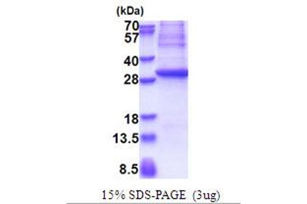 GAD Protein (AA 1-224) (His tag)