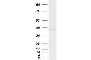 MMAA Protein (Myc-DYKDDDDK Tag)