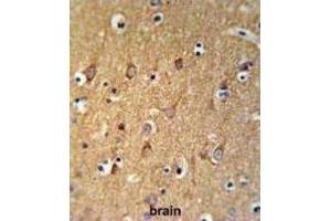 Immunohistochemistry (IHC) image for anti-Sphingomyelin Synthase 2 (SGMS2) antibody (ABIN3004329) (Sphingomyelin Synthase 2 抗体)