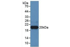 Detection of Recombinant HPA, Human using Monoclonal Antibody to Heparanase (HPSE) (HPSE 抗体  (AA 400-543))