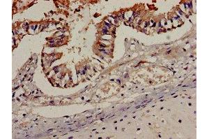 Immunohistochemistry analysis of human lung tissue using ABIN7145942 at dilution of 1:100 (CCR7 抗体  (AA 332-378))