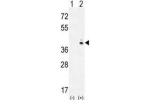 Western Blotting (WB) image for anti-Galactokinase 1 (GALK1) antibody (ABIN3002977) (GALK1 抗体)