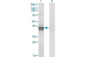 Western Blotting (WB) image for anti-ST3 beta-Galactoside alpha-2,3-Sialyltransferase 2 (ST3GAL2) (AA 28-127) antibody (ABIN562877)
