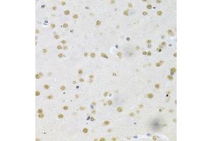 Immunohistochemistry of paraffin-embedded mouse brain using CBFB Antibody (ABIN6130041, ABIN6138000, ABIN6138001 and ABIN6220926) at dilution of 1:200 (40x lens).