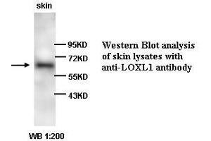 Image no. 1 for anti-Lysyl Oxidase-Like 1 (LOXL1) antibody (ABIN790876) (LOXL1 抗体)