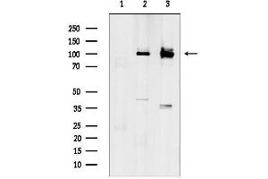 anti-Solute Carrier Family 9 (Sodium/hydrogen Exchanger), Member 6 (SLC9A6) (C-Term) antibody